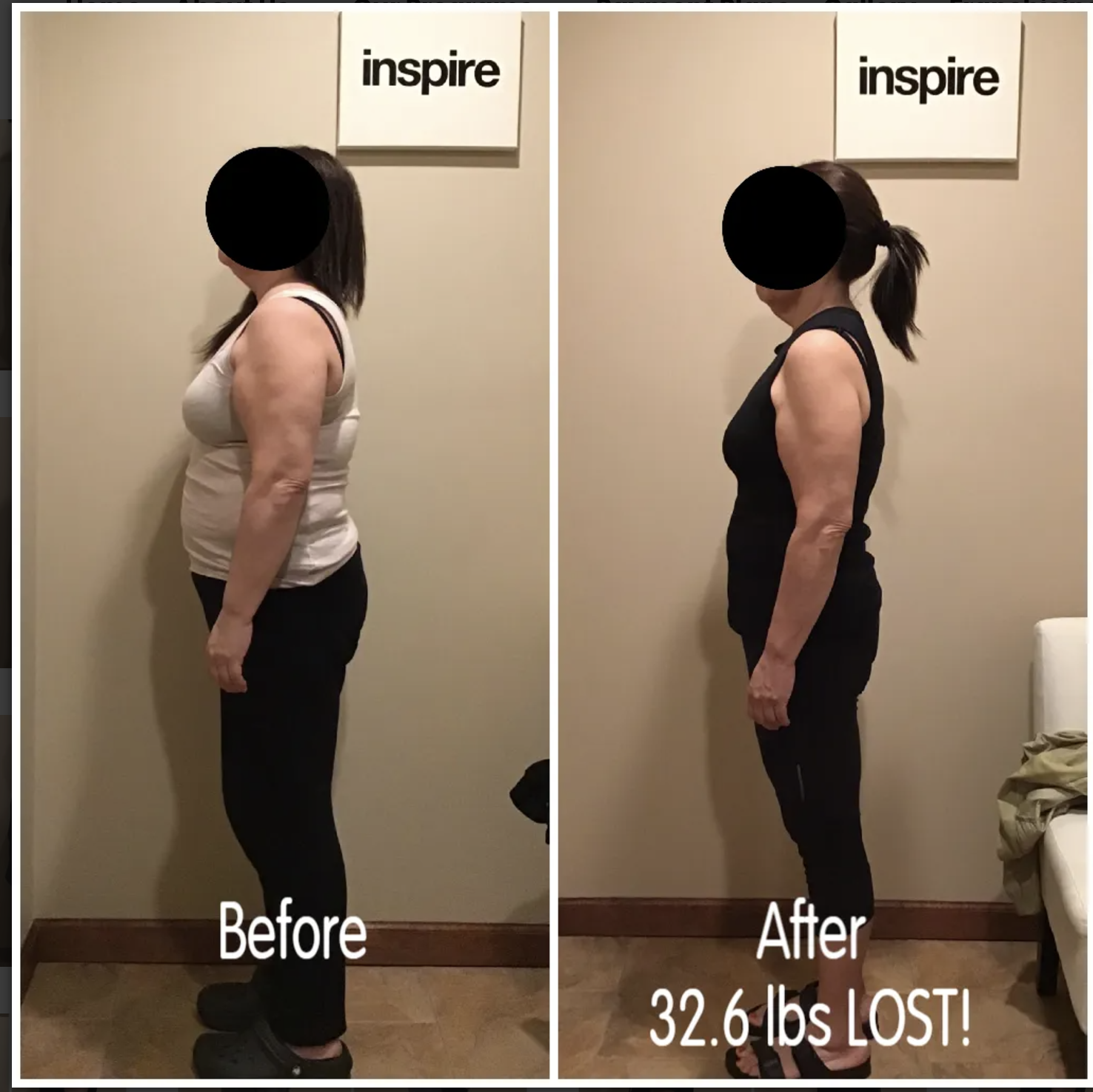 Patient — lost 32.6 lbs